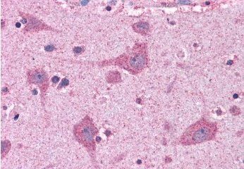 FACL4/ACSL4 Antibody