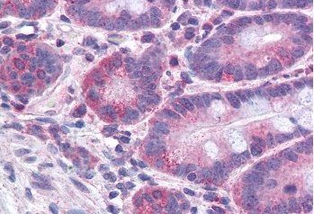 FACL4/ACSL4 Antibody