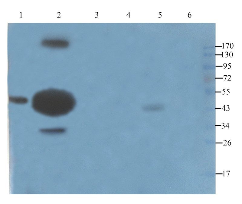 ACTA2 Rabbit Polyclonal Antibody