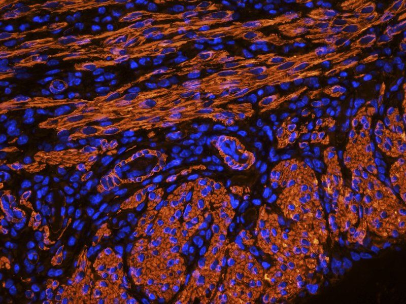ACTA2 Rabbit Polyclonal Antibody
