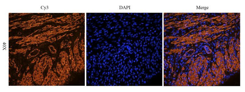 ACTA2 Rabbit Polyclonal Antibody