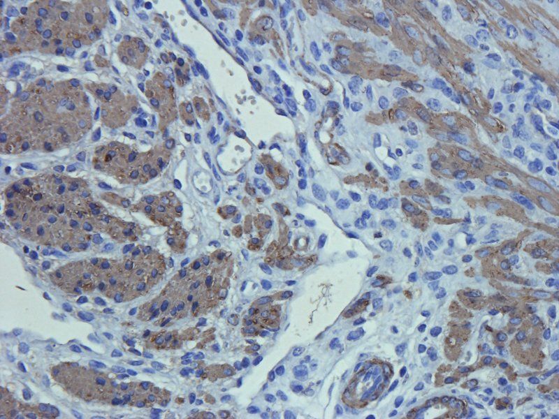 ACTA2 Rabbit Polyclonal Antibody