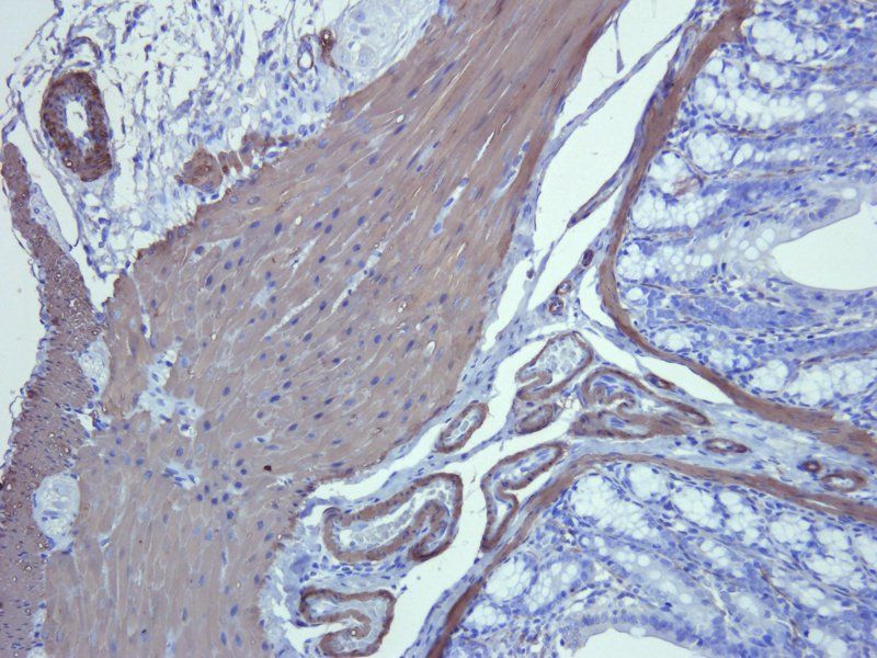 ACTA2 Rabbit Polyclonal Antibody