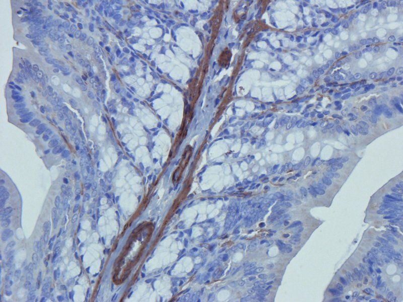 ACTA2 Rabbit Polyclonal Antibody