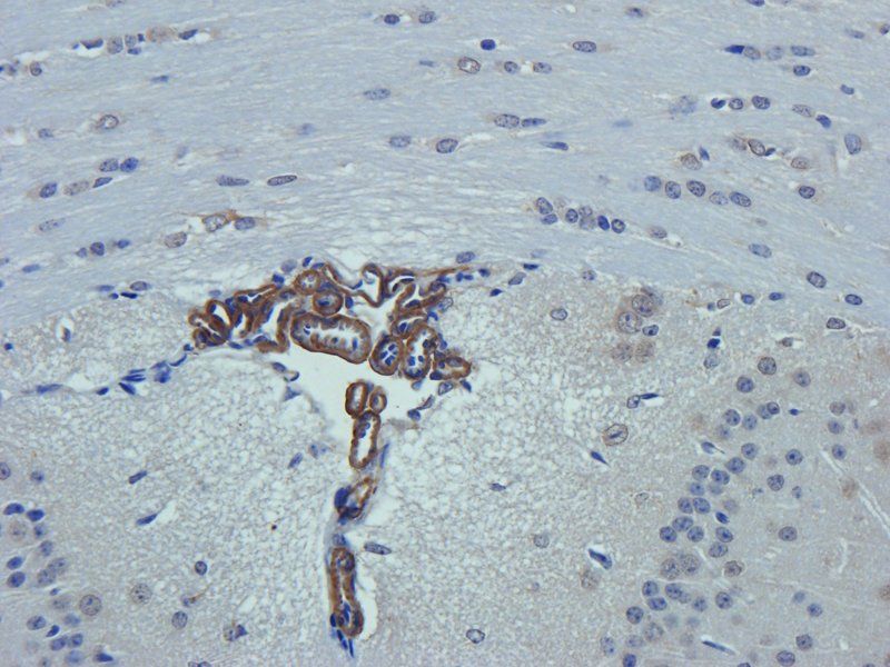 ACTA2 Rabbit Polyclonal Antibody