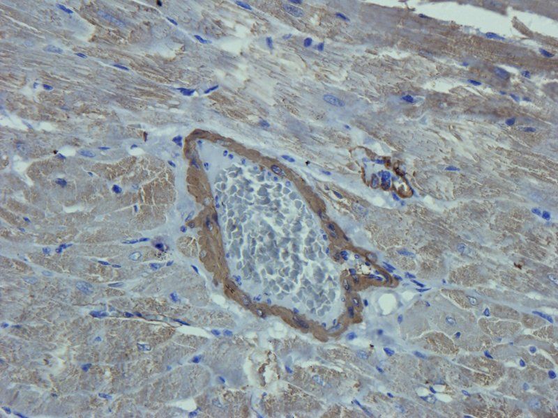 ACTA2 Rabbit Polyclonal Antibody