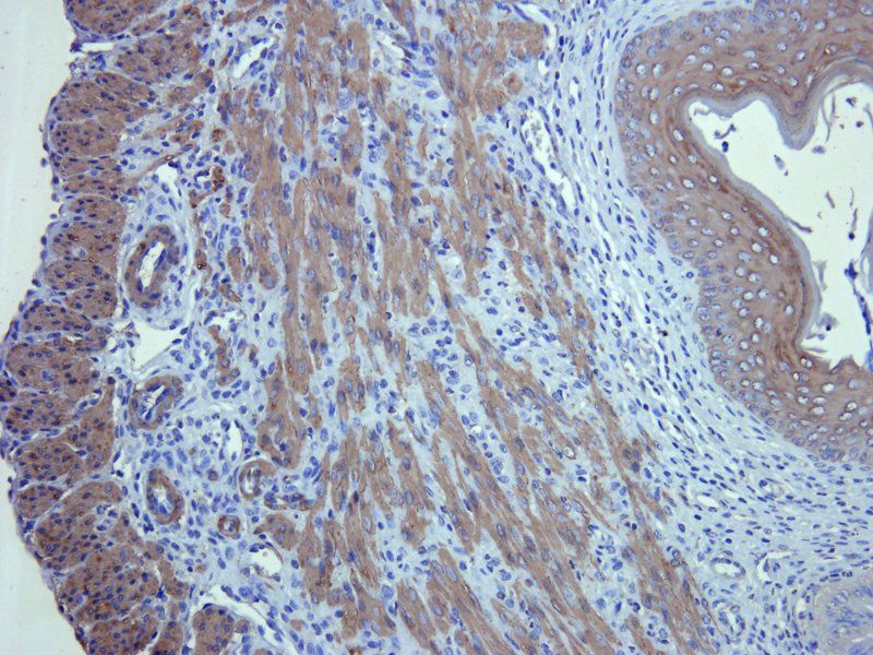 ACTA2 Rabbit Polyclonal Antibody