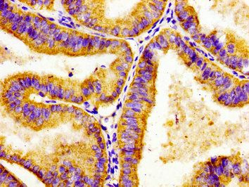 ADCY8 Antibody