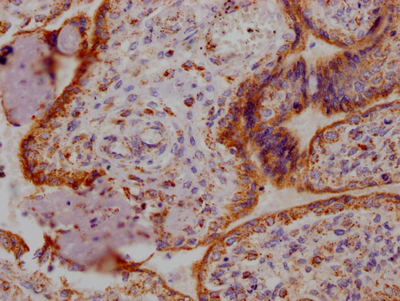 ANGPT2 Antibody