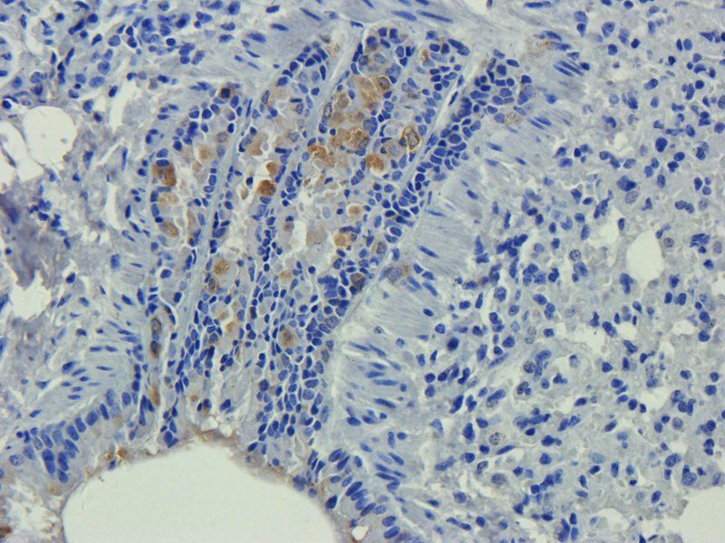 Apolipoprotein E Rabbit Polyclonal Antibody