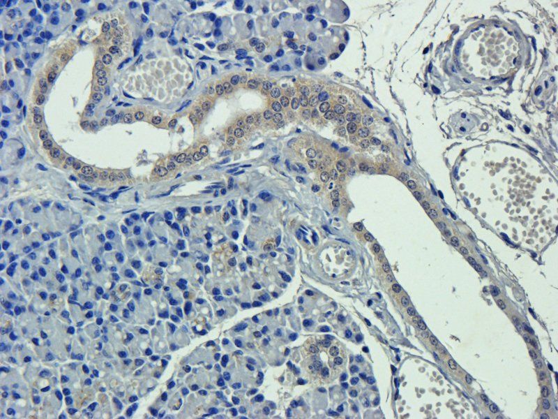 Apolipoprotein E Rabbit Polyclonal Antibody
