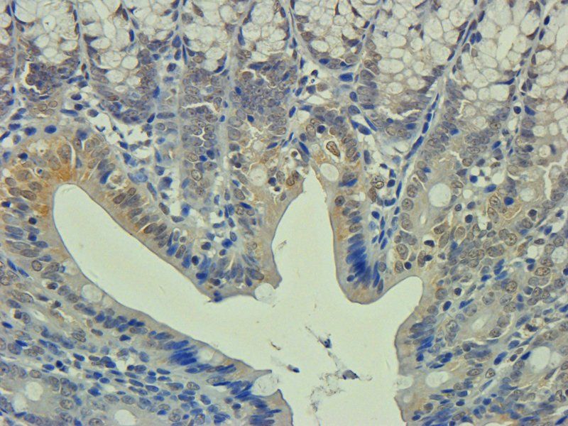 Apolipoprotein E Rabbit Polyclonal Antibody