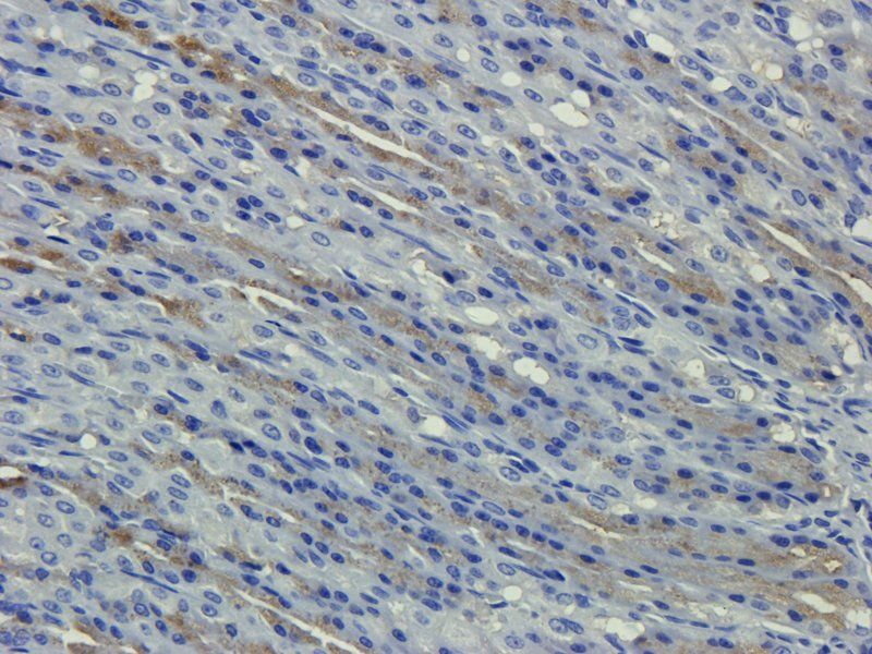 Apolipoprotein E Rabbit Polyclonal Antibody