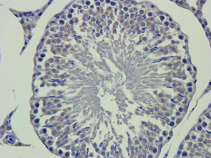 Apolipoprotein E Rabbit Polyclonal Antibody