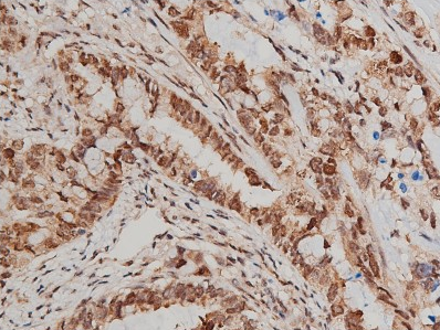 Phospho-pan-AKT1/2/3 (Ser473) Antibody
