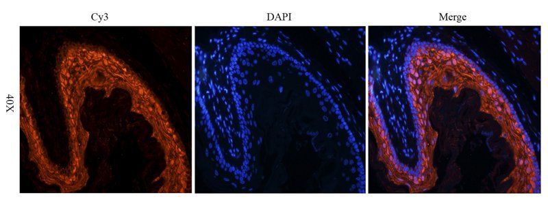 BMP2 Rabbit Polyclonal Antibody