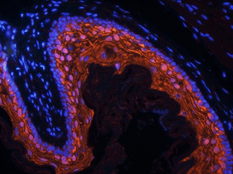 BMP2 Rabbit Polyclonal Antibody