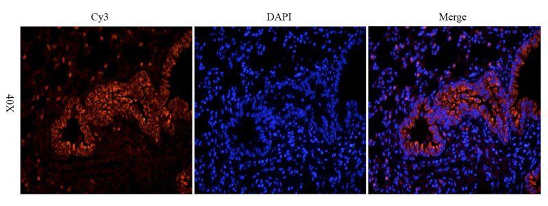 BMP2 Rabbit Polyclonal Antibody
