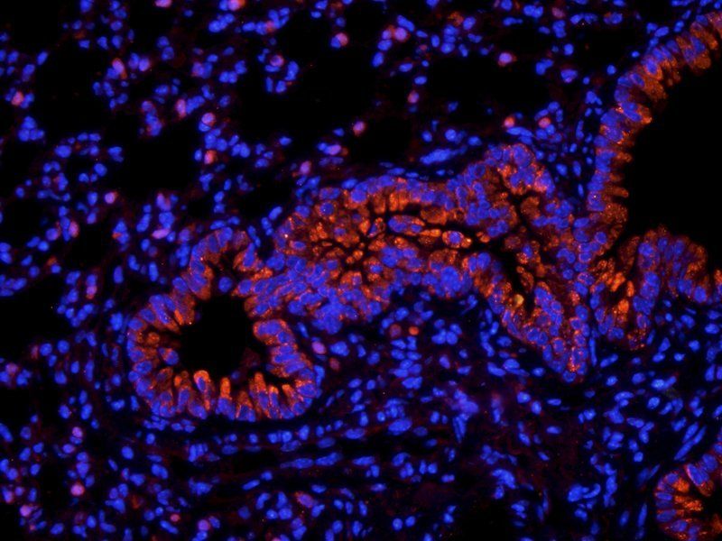 BMP2 Rabbit Polyclonal Antibody