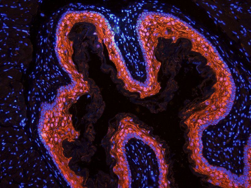 BMP2 Rabbit Polyclonal Antibody