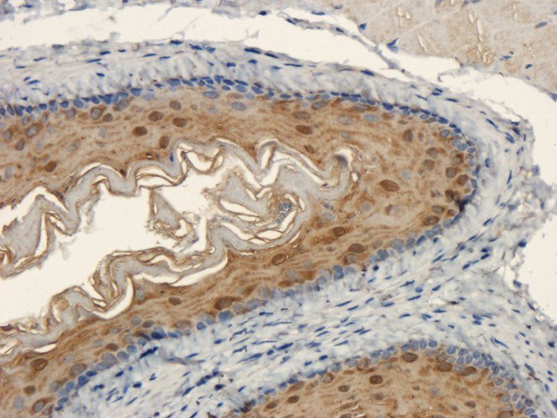 BMP2 Rabbit Polyclonal Antibody