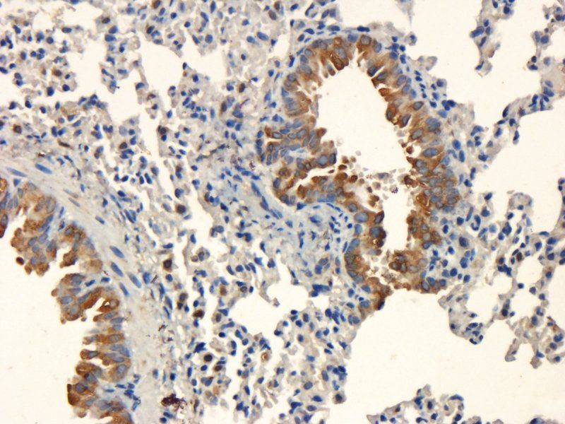 BMP2 Rabbit Polyclonal Antibody