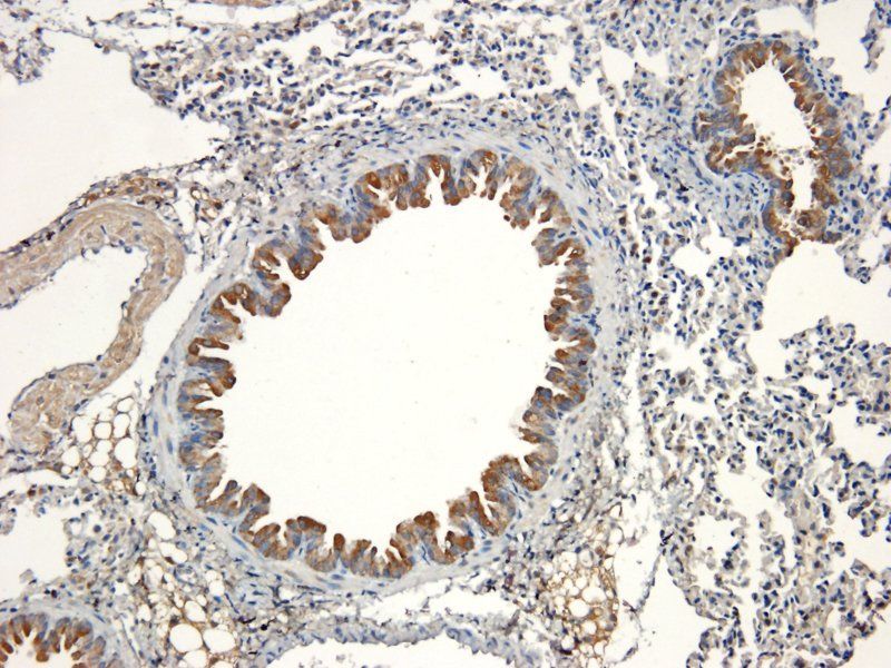 BMP2 Rabbit Polyclonal Antibody