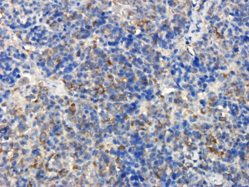 BMP2 Rabbit Polyclonal Antibody