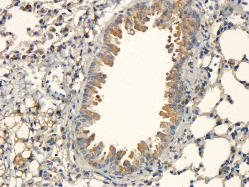 BMP2 Rabbit Polyclonal Antibody