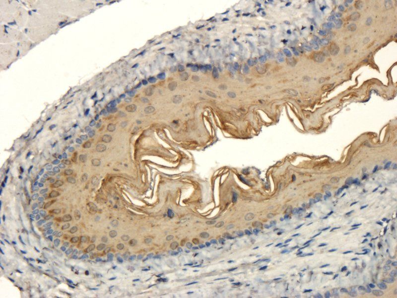 BMP2 Rabbit Polyclonal Antibody