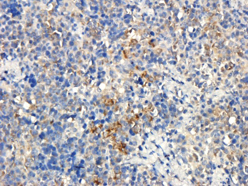 BMP2 Rabbit Polyclonal Antibody