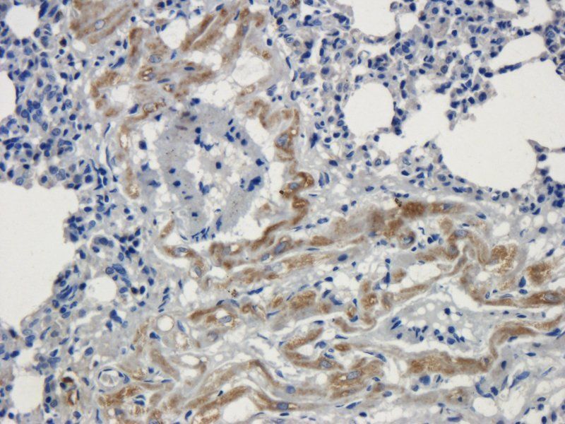 BMP2 Rabbit Polyclonal Antibody