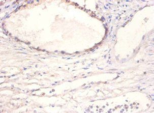 BMP2 Antibody