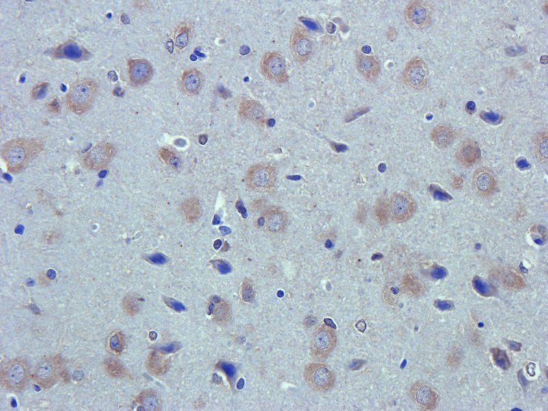 CA125 Rabbit Polyclonal Antibody