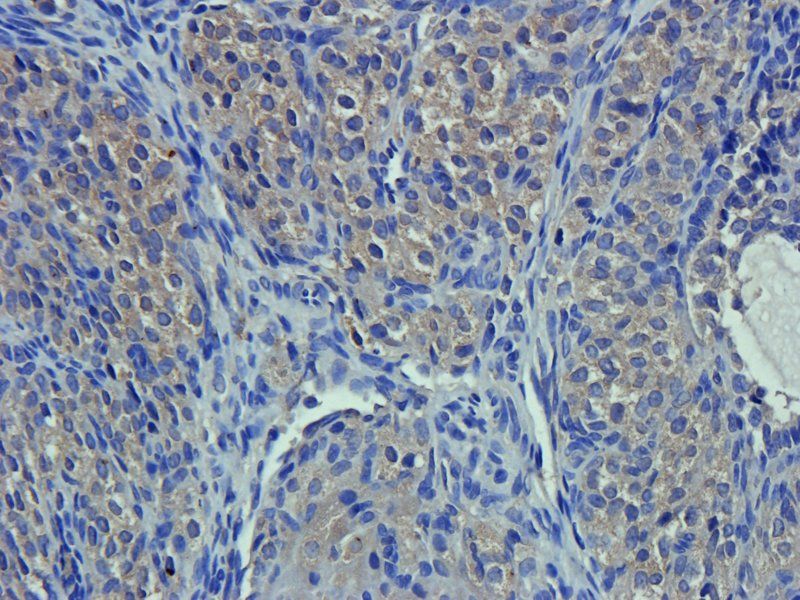 CA125 Rabbit Polyclonal Antibody