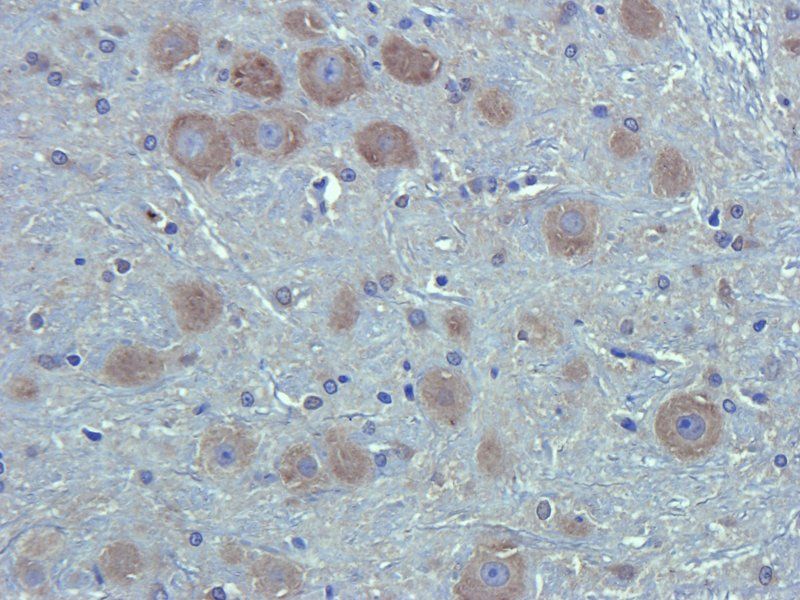 CA125 Rabbit Polyclonal Antibody