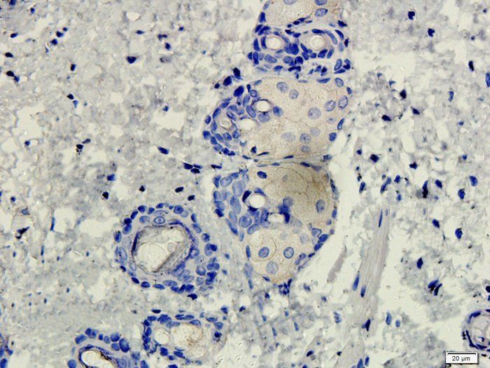 CD206 Rabbit Polyclonal Antibody