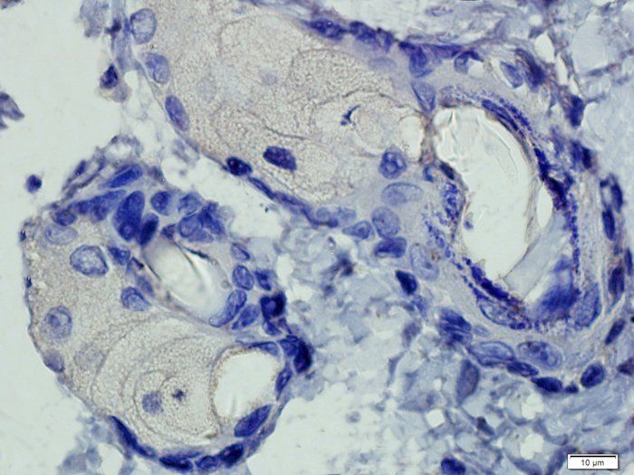 CD206 Rabbit Polyclonal Antibody