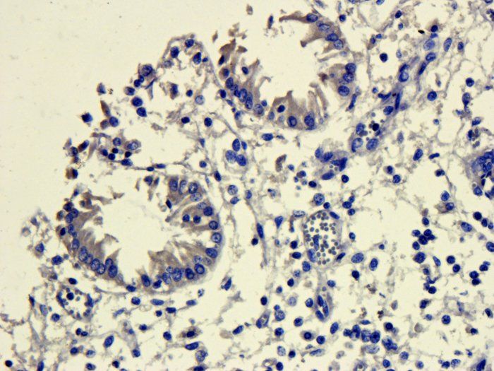 CD206 Rabbit Polyclonal Antibody