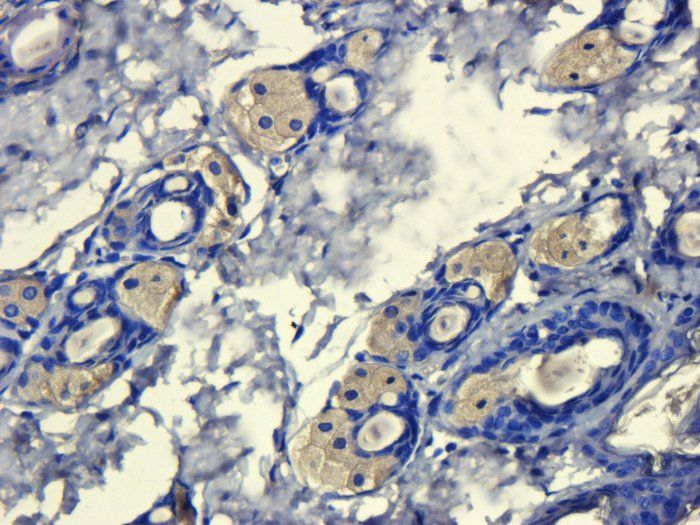 CD206 Rabbit Polyclonal Antibody
