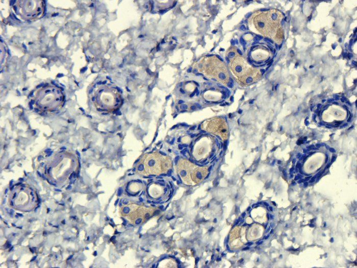 CD206 Rabbit Polyclonal Antibody
