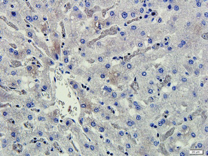 CD206 Rabbit Polyclonal Antibody