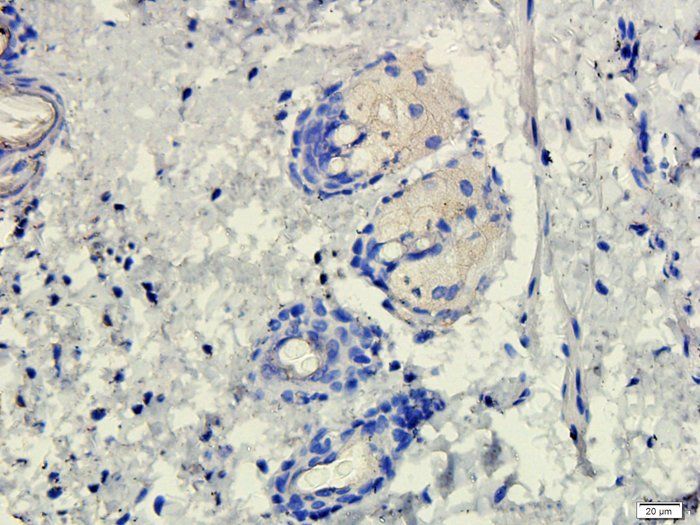 CD206 Rabbit Polyclonal Antibody