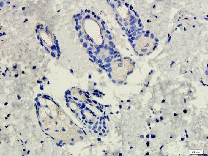 CD206 Rabbit Polyclonal Antibody
