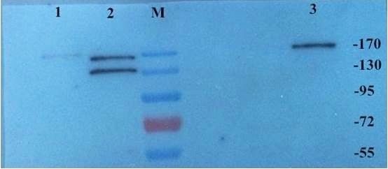 CD206 Rabbit Polyclonal Antibody