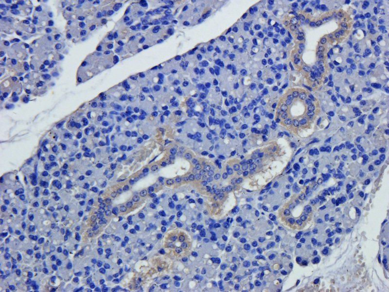 CD206 Rabbit Polyclonal Antibody