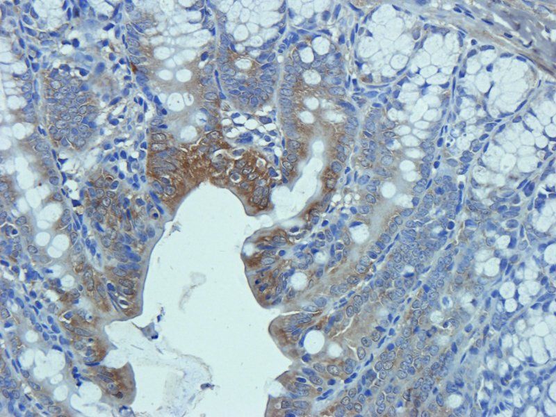CD206 Rabbit Polyclonal Antibody