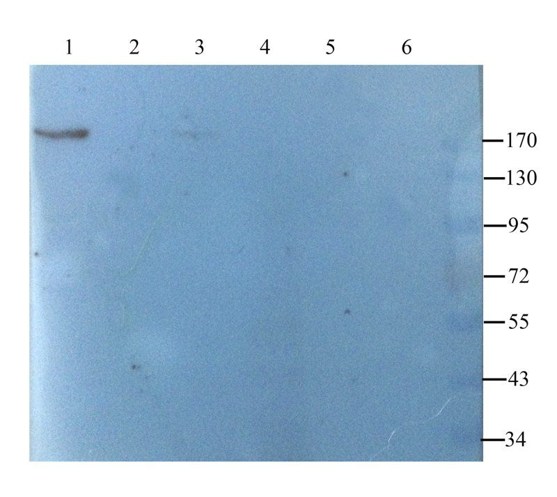CD206 Rabbit Polyclonal Antibody