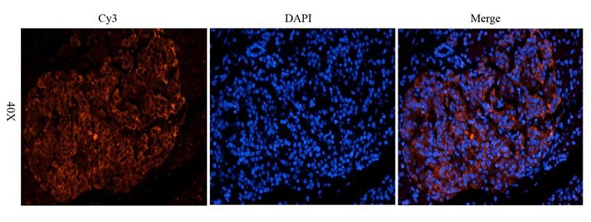 CD38 Rabbit Polyclonal Antibody