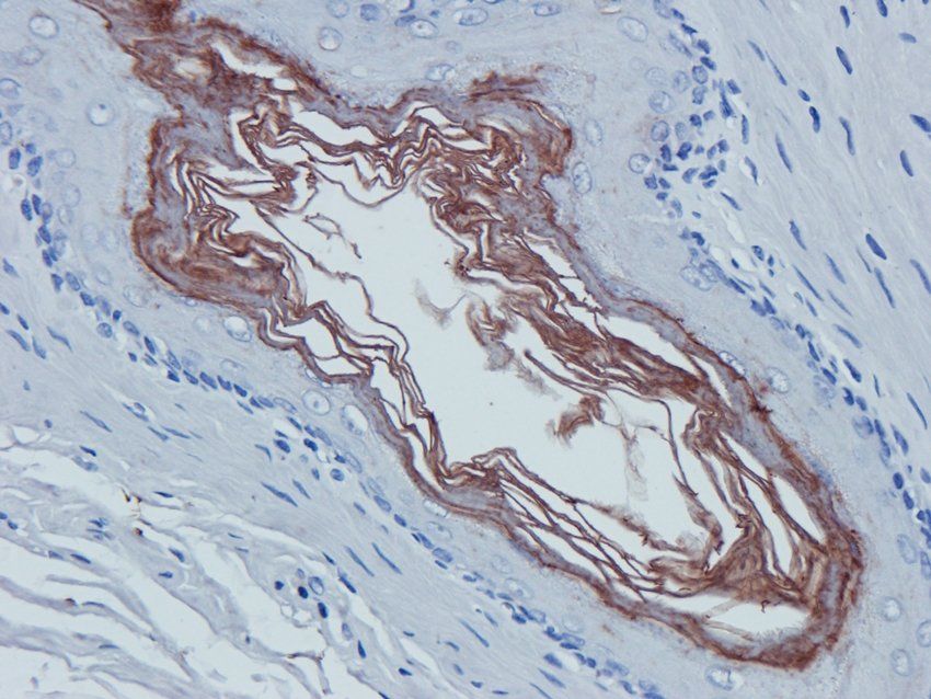 CD38 Rabbit Polyclonal Antibody